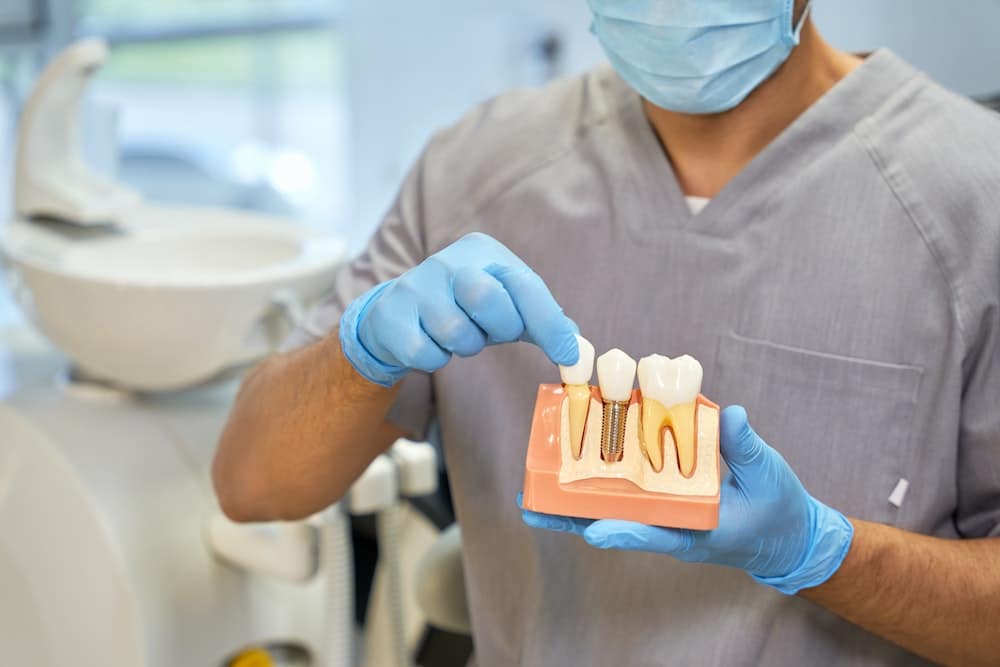 Quels sont les avantages des implants dentaires ?